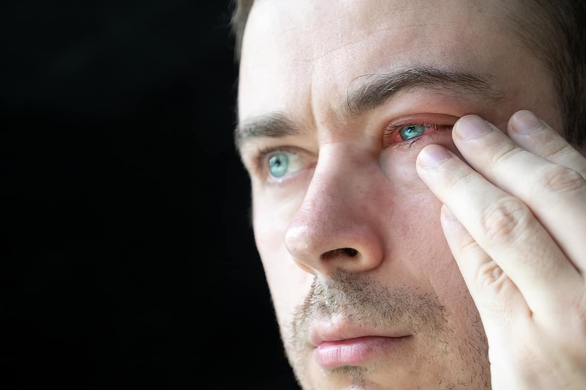 hombre joven con ojo rojo