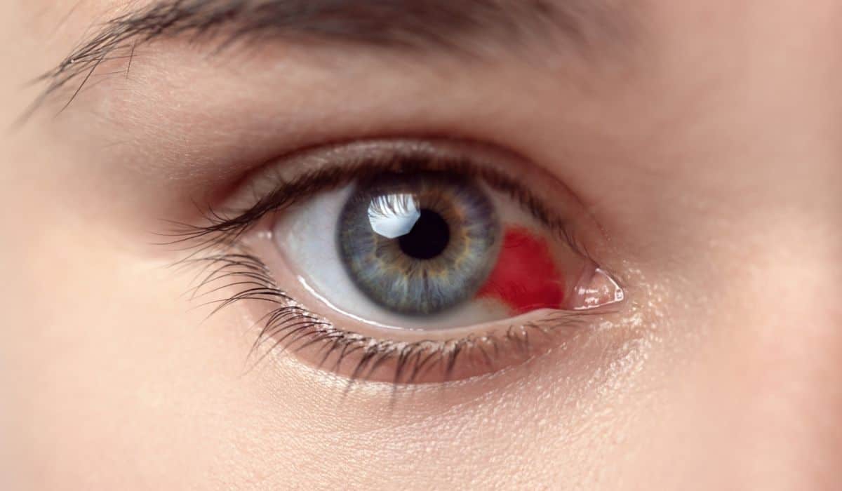 ¿Cuáles son los signos de alarma en los ojos?